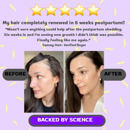 FRIEDA : 3-in-1 Hair Revival w/ Red Light Therapy